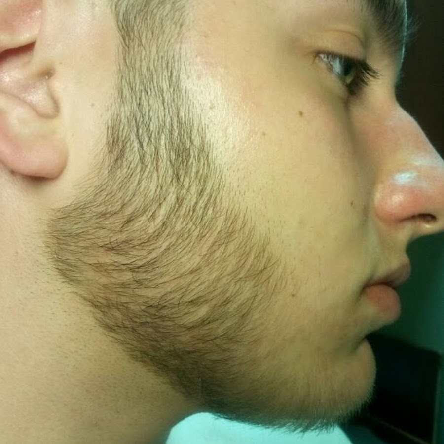 Если растет борода то уровень тестостерона низкий